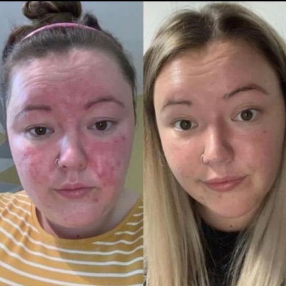 Two 180 Face Wash - Picture 10 of 14